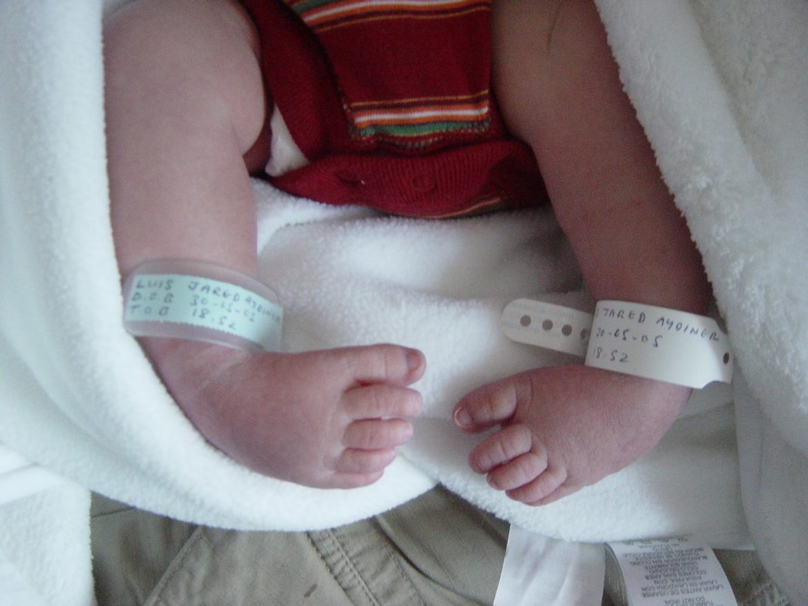 Clubfoot challenges and victories: A parent's Story 12 years On