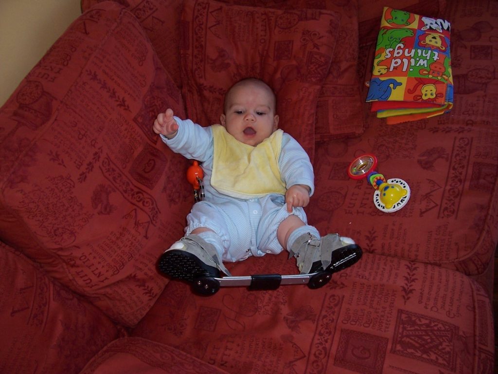 Clubfoot challenges and victories: A parent's Story 12 years On