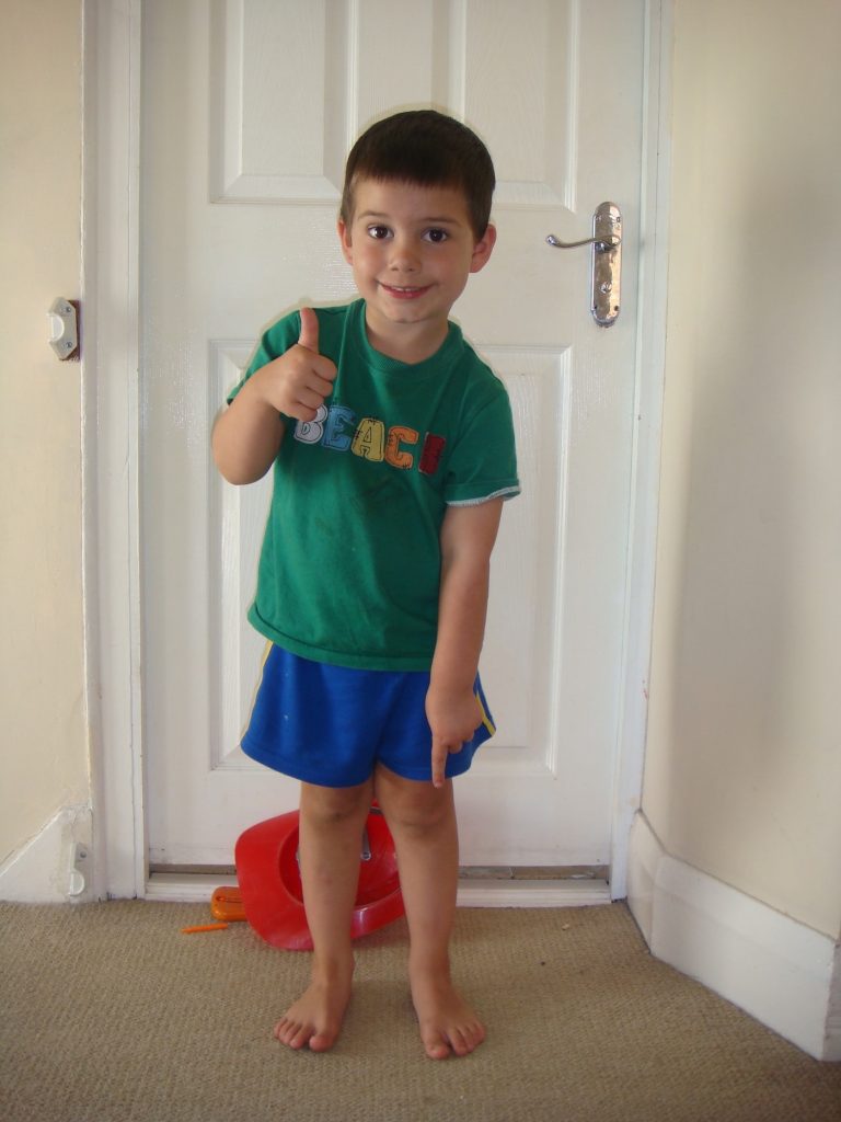 Clubfoot challenges and victories: A parent's Story 12 years On