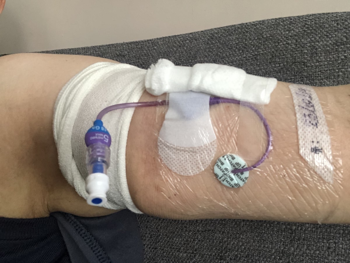 What having chemo really feels like