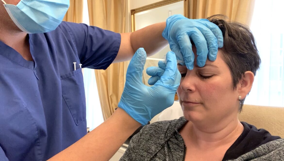 botox for migraines