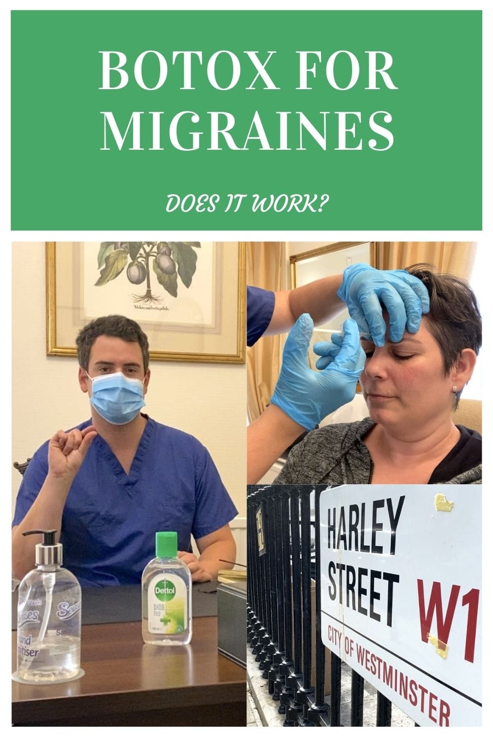 I undergo the needle to see if botox for migraines works!
